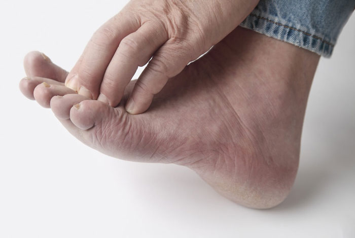 راهنمای بهبودی برای بیماران دیابتی: نکات بهداشت پا برای حفظ سلامتی پاهای شما