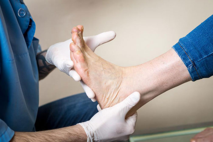 در این مقاله، ما به خطر جدی در پای بیماران دیابتی می‌پردازیم. بیاموزید چگونه از این مشکلات پیشگیری کنید و به بهبود وضعیت پای خود بپردازید.