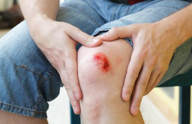 درمان عفونت زخم , و جلوگیری از وخیم تر شدن زخم