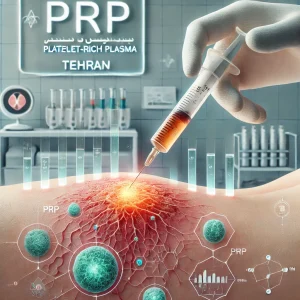 مقدمه‌ای بر درمان PRP برای ترمیم زخم با تزریق پلاسمای غنی از پلاکت در ناحیه زخم در کلینیک زخم پاشنه تهران.