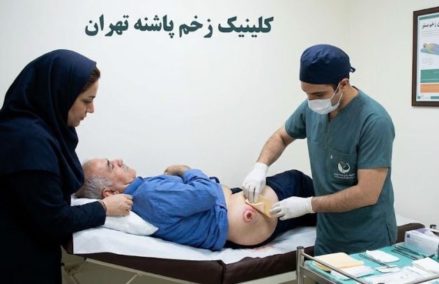 پانسمان تخصصی زخم تروکانتر با بررسی مراحل و درجات زخم بستر.