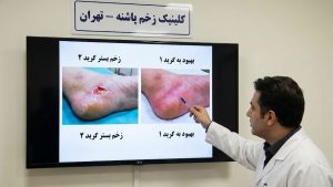 پزشک متخصص در حال توضیح دادن روی مانیتور درباره اینکه علائم بالینی و مراحل درمان سوختگی درجه ۲ چیست.