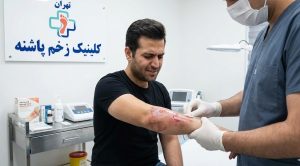 بیمار در کلینیک تخصصی زخم پاشنه در حال معاینه شدن برای تشخیص اینکه آیا جراحت دست او سوختگی درجه ۲ چیست.