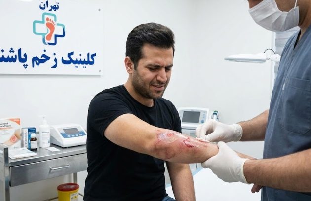 بیمار در کلینیک تخصصی زخم پاشنه در حال معاینه شدن برای تشخیص اینکه آیا جراحت دست او سوختگی درجه ۲ چیست.
