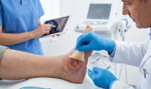 استفاده همزمپزشک در حال قرار دادن پانسمان پیشرفته ماتریس سلول بنیادی (Stem Cell Matrix) روی زخم عمیق پاشنه پا جهت تحریک بافت‌سازی و درمان قطعی زخم پای دیابتی.ان از تکنولوژی‌هایپزشک در حال قرار دادن پانسمان پیشرفته ماتریس سلول بنیادی (Stem Cell Matrix) روی زخم عمیق پاشنه پا جهت تحریک بافت‌سازی و درمان قطعی زخم پای دیابتی. پیشرفته گاز ازون در محفظه بسته و دستگاه پلاسمای سرد دستی برای استریل‌سازی و درمان قطعی زخم پای دیابتی مقاوم.