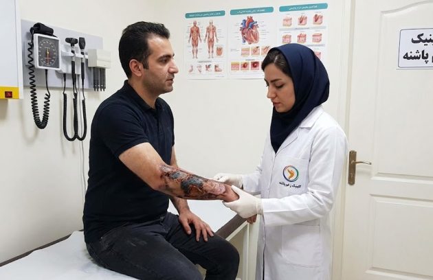 پزشک متخصص در حال معاینه و ارزیابی بالینی برای درمان زخم سوختگی درجه ۳ روی ساعد دست بیمار مرد در کلینیک زخم پاشنه.