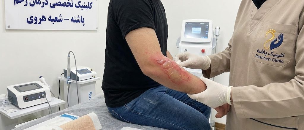 متخصص کلینیک پاشنه در حال معاینه و درمان تخصصی زخم سوختگی روی دست بیمار در شعبه هروی.