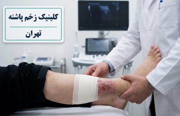 پزشک متخصص در حال معاینه و ارزیابی پای بیمار جهت شروع پروسه درمان زخم عروقی در تهران در کلینیک پاشنه.