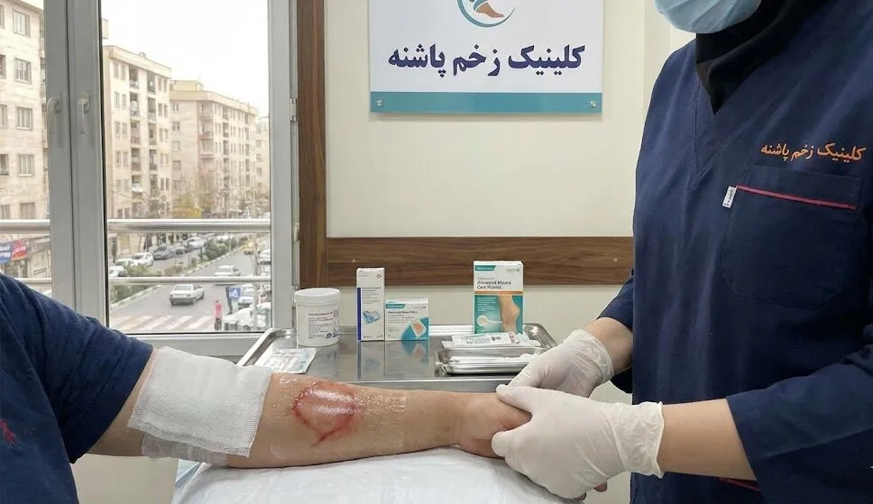 درمان زخم سوختگی در تهران در محیط استریل کلینیک پاشنه هروی