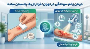 استفاده از تجهیزات پیشرفته برای درمان زخم سوختگی در تهران