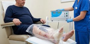 اوزون تراپی زخم پای دیابتی با استفاده از کیسه مخصوص بگ اوزون در کلینیک پاشنه تهران.
