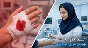 درمان فوری و تخصصی خون‌ریزی زخم در کلینیک پاشنه تهران توسط متخصص