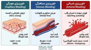 اینفوگرافیک مقایسه انواع خونریزی مویرگی، سیاهرگی و شریانی در کلینیک پاشنه خونریزی زخم