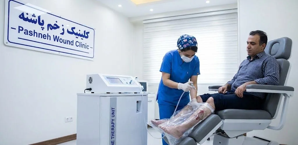 فرآیند تخصصی اوزون تراپی زخم پا به روش موضعی در کلینیک زخم پاشنه تهران